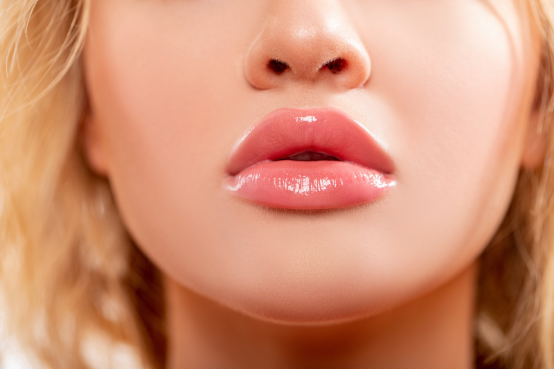 Young Girl after Thining lips Treatments in Walnut Creek | Walnut Creek, CA | Walnut Creek Aesthetics