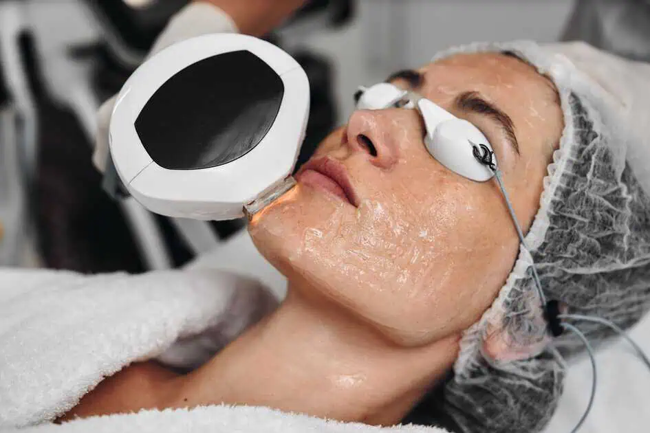 IPL Photofacial Treatment In Walnut Creek, CA by Walnut Creek Aesthetics