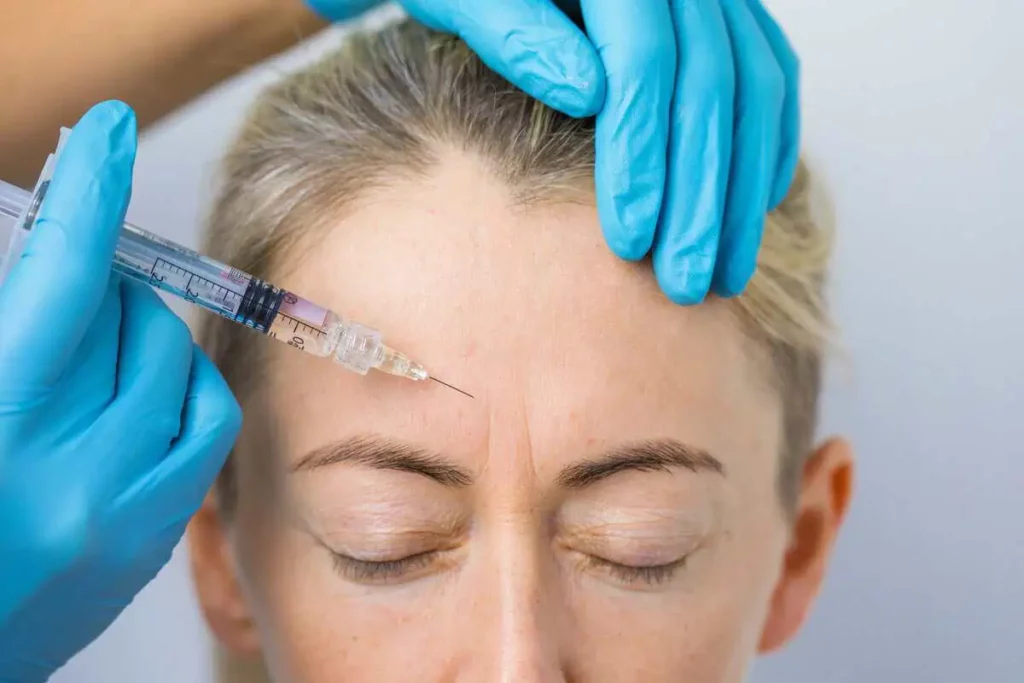 Wrinkle relaxer treatment being performed to reduce forehead lines at Walnut Creek Aesthetics in Walnut Creek, CA